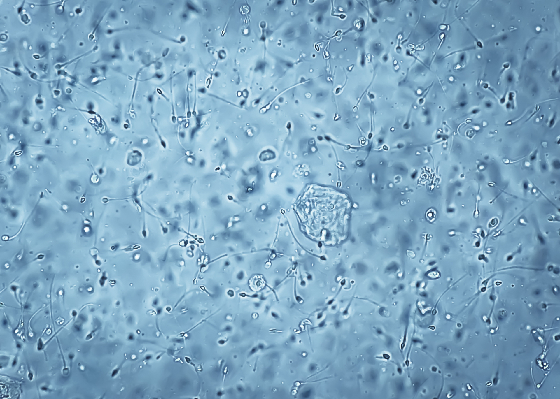 Microscopy view of a semen sample analyzed at Gulf Coast Andrology
